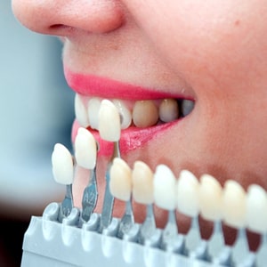 How To Prepare My Teeth for Teeth Whitening? | Glendale, CA