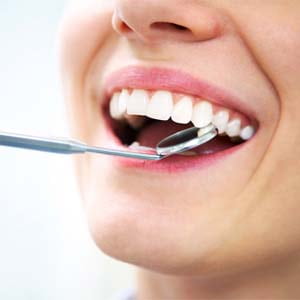 Teeth Cleanings Consist of: