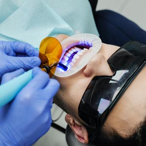 Types of Cosmetic Dentistry Procedures